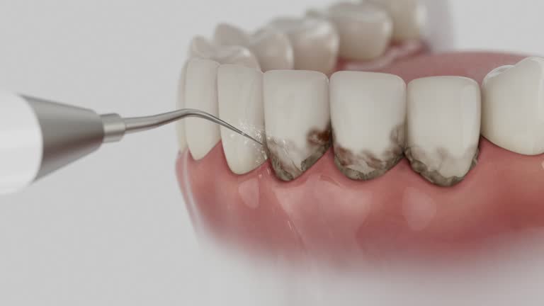 Reliable Dental contractor in Glouster, OH by Dentist Open Now